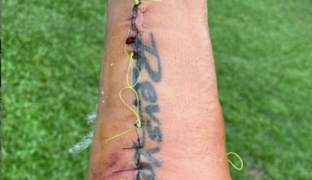 Sebastián Martínez fue operado