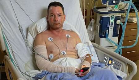 La salud de Trebbiani tras sufrir quemaduras