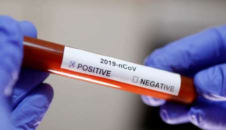 ''El Coronavirus te deja tirado como un perro''