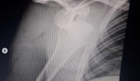 Del Superbike Argentino al Mundial