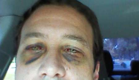 A cuatro milímetros de ser un golpe mortal