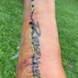 Sebastián Martínez fue operado