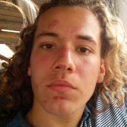 “Me duelen más los puntos que la caída”