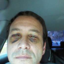 A cuatro milímetros de ser un golpe mortal